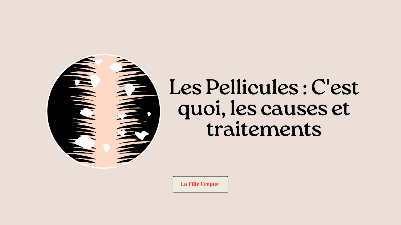 Les Pellicules :  C&rsquo;est quoi, les causes et traitements